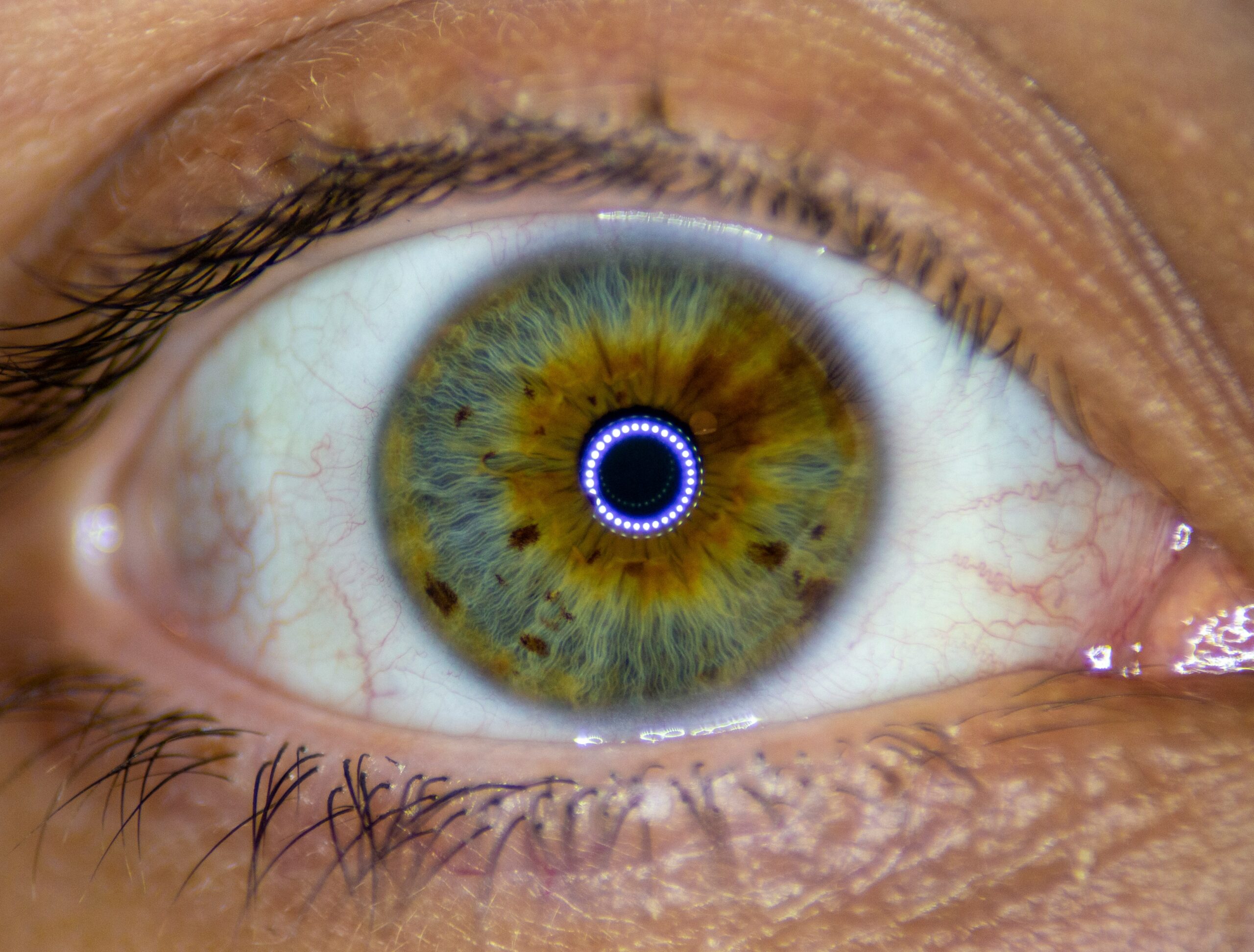 Scottish Clinical Software Technology Aims to Tackle Global Eye Care Backlog
