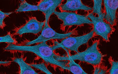 mRNA Vaccine to Target Melanoma and Lung Cancer